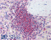 Anti-THOC5 Antibody (aa338-350) IHC-plus LS-B913