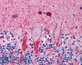 Anti-TP53I11 / PIG11 Antibody (aa179-189) IHC-plus LS-B915