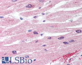 Anti-CCN4 / WISP1 Antibody (aa185-200) IHC-plus LS-B916