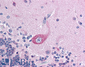 Anti-BRD4 Antibody (aa651-700) IHC-plus LS-B924