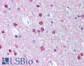 Anti-CACNB1 Antibody (aa21-70) IHC-plus LS-B926