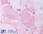 Anti-CACNG1 / CACNG Antibody (aa66-115) IHC-plus LS-B928