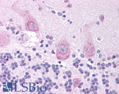 Anti-CHRNA3 Antibody (aa26-75) IHC-plus LS-B934