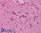 Anti-CHRNB3 Antibody (aa176-225) IHC-plus LS-B938