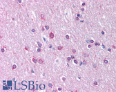 Anti-CLDN11 / Claudin 11 Antibody (C-Terminus) IHC-plus LS-B939