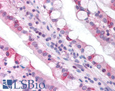 Anti-CLDN18 / Claudin 18 Antibody (C-Terminus) IHC-plus LS-B940