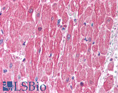 Anti-CLIC5 Antibody (C-Terminus) IHC-plus LS-B941