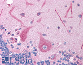 Anti-FOXE3 Antibody (aa235-284) IHC-plus LS-B949