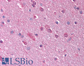Anti-GABRQ / THETA Antibody (aa31-80) IHC-plus LS-B957
