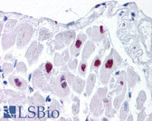 Anti-HDAC2 Antibody (aa419-468) IHC-plus LS-B965