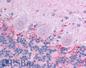 Anti-KCNIP4 / KCHIP4 Antibody (aa27-76) IHC-plus LS-B977