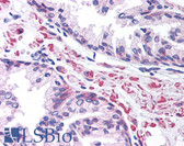 Anti-LEF1 Antibody (aa51-100) IHC-plus LS-B984