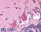 Anti-PITX3 Antibody (N-Terminus) IHC-plus LS-B994