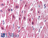 Anti-SCNN1B / ENaC Beta Antibody (C-Terminus) IHC-plus LS-B999