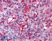 Anti-SLC4A1 / Band 3 / AE1 Antibody (aa184-233) IHC-plus LS-B1001