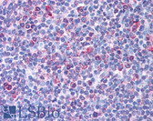 Anti-TRIM13 Antibody (aa165-214) IHC-plus LS-B1007
