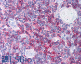 Anti-CD8A / CD8 Alpha Antibody (C-Terminus) IHC-plus LS-B1062