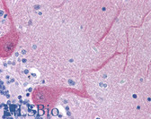 Anti-FASLG / Fas Ligand Antibody (N-Terminus) IHC-plus LS-B1085