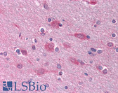 Anti-FLI1 Antibody (C-Terminus) IHC-plus LS-B1089