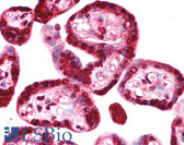 Anti-TRIM34 / RNF21 Antibody (aa49-98) IHC-plus LS-B1106