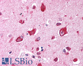 Anti-TRIM35 Antibody (aa145-194) IHC-plus LS-B1107