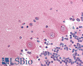 Anti-ADD1 Antibody (Ser726) IHC-plus LS-B1167