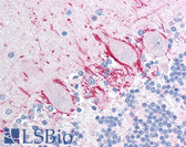 Anti-AKT1 Antibody (Thr308) IHC-plus LS-B1168