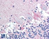 Anti-BAD Antibody (Ser112) IHC-plus LS-B1172