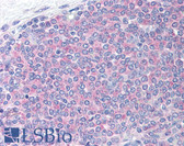 Anti-BCL2 / Bcl-2 Antibody (Thr56) IHC-plus LS-B1173