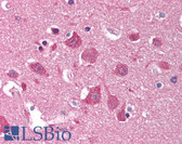 Anti-BCL2L1 / BCL-XL Antibody (Ser62) IHC-plus LS-B1175