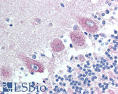 Anti-CAMK2A / CaMKII Alpha Antibody (Thr286) IHC-plus LS-B1178