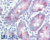 Anti-CDK1 / CDC2 Antibody (Tyr15) IHC-plus LS-B1180