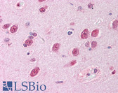 Anti-AKT1 Antibody (phospho-Thr308) IHC-plus LS-B1190