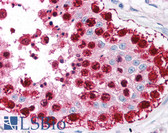 Anti-MAGEA1 / MAGE 1 Antibody (aa245-259) IHC-plus LS-B1219