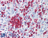 Anti-MMP7 Antibody (C-Terminus) IHC-plus LS-B1237