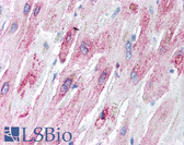 Anti-MMP8 Antibody IHC-plus LS-B1238
