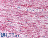 Anti-PARP1 Antibody (N-Terminus) IHC-plus LS-B1243
