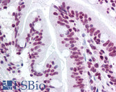 Anti-STAT3 Antibody (phospho-Tyr705) IHC-plus LS-B1259