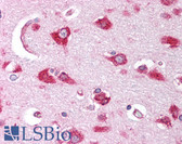 Anti-TNFRSF1B / TNFR2 Antibody (C-Terminus) IHC-plus LS-B1273