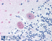 Anti-YWHAZ / 14-3-3 Zeta Antibody (Internal) IHC-plus LS-B1283