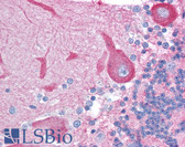Anti-GRB4 / NCK2 Antibody (aa119-276) IHC-plus LS-B1286