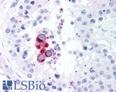 Anti-NAK / TBK1 Antibody (aa563-577, clone 108A429) IHC-plus LS-B1317