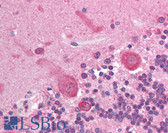 Anti-AKT3 Antibody (aa119-136, clone 66C1247.1) IHC-plus LS-B1319