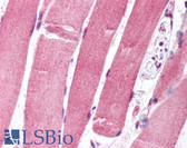 Anti-FOXO1 / FKHR Antibody (aa242-655, clone 7h3) IHC-plus LS-B1322