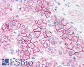 Anti-AKT1 Antibody (N-Terminus) IHC-plus LS-B1327
