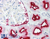 Anti-BAG1 / BAG-1 Antibody (C-Terminus) IHC-plus LS-B1331