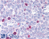 Anti-BAX Antibody (N-Terminus) IHC-plus LS-B1333