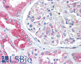 Anti-BCAP31 / BAP31 Antibody (Internal) IHC-plus LS-B1335