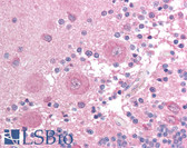 Anti-BCL2L14 / BCL-G Antibody (C-Terminus) IHC-plus LS-B1338