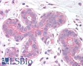 Anti-TIGAR Antibody (Internal) IHC-plus LS-B1341